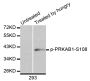 Anti-Phospho-PRKAB1-S108 antibody (STJ29363)