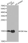 Anti-Acetyl-Histone H3-K14 antibody (STJ29396)