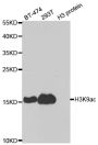 Anti-Acetyl-Histone H3-K9 antibody (2-19) (STJ29397)