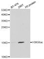 Anti-Acetyl-Histone H3-K56 antibody (STJ29398)
