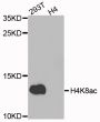 Anti-Acetyl-Histone H4-K8 antibody (STJ29400)