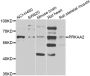 Anti-PRKAA2 antibody (270-552) (STJ29478)