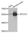 Anti-MT-CO1 antibody (415-514) (STJ29669)
