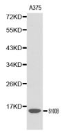Anti-S100B antibody (1-92) (STJ29811)