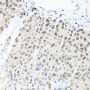 Anti-PARP1 antibody (81-390) (STJ29827)
