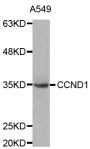Anti-CCND1 antibody (200-295) (STJ29894)