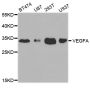 Anti-VEGFA antibody (68-147) (STJ29920)