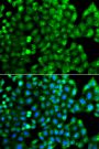 Anti-HLA-DRB1 antibody (30-230) (STJ29998)