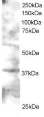 Anti-GRAP2/GRID/Grf40 antibody (C-Term) (STJ70041)