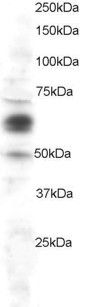 Anti-COX1/PTGS1 antibody (C-Term) (STJ70105)