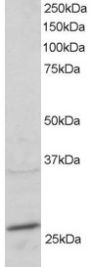 Anti-RAB11A/YL8 antibody (C-Term) (STJ70228)