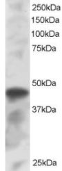 Anti-ICSBP1/IRF8 antibody (C-Term) (STJ70234)