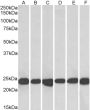 Anti-PARK7/DJ-1 antibody (C-Term) (STJ70331)