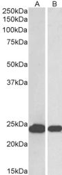 Anti-PARK7/DJ-1 antibody (C-Term) (STJ70331)