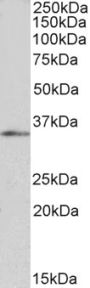 Anti-FOXB1/FKH5 antibody (C-Term) (STJ70383)