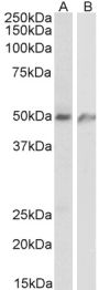 Anti-ECSM2 antibody (C-Term) (STJ70551)