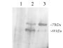 Anti-PCSK9 antibody (C-Term) (STJ70676)
