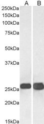 Anti-SNAP25 antibody (C-Term) (STJ70695)