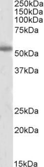 Anti-Tyrosine Hydroxylase antibody (C-Term) (STJ70696)