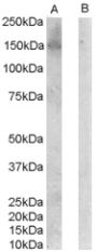 Anti-ERBB3/HER3 antibody (C-Term) (STJ70764)