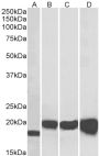 Anti-SOD1 antibody (Internal) (STJ70903)