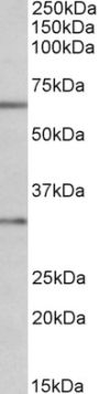 Anti-Caspase 3 antibody (Internal) (STJ70944)