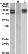 Anti-PCSK9 antibody (164-175) (STJ71045)