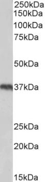 Anti-Uncoupling protein 2/UCP2 antibody (Internal) (STJ71137)