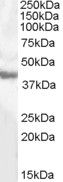 Anti-GOT1 antibody (22-35) (STJ71351)