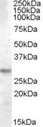Anti-14-3-3 tau/YWHAQ antibody (Internal) (STJ71355)