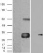 Anti-WISP1 antibody (C-Term) (STJ71370)