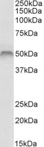 Anti-FSCN1 antibody (Internal) (STJ71472)