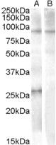 Anti-APOBEC2 antibody (12-26) (STJ71478)