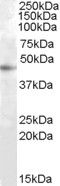 Anti-RASSF6 antibody (Internal) (STJ71497)