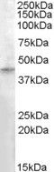 Anti-RASSF8 antibody (Internal) (STJ71498)