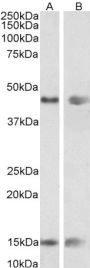 Anti-Pnpla3/Adiponutrin-Mouse antibody (Internal) (STJ71499)