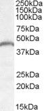 Anti-Pnpla3/Adiponutrin-Mouse antibody (Internal) (STJ71499)