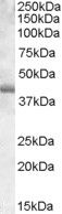 Anti-PU.1 antibody (Internal) (STJ71510)