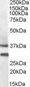Anti-MC5R antibody (N-Term) (STJ71515)