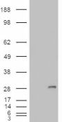 Anti-IGFBP6 antibody (Internal) (STJ71555)
