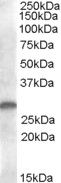 Anti-CLEC2/CLEC1B antibody (Internal) (STJ71575)