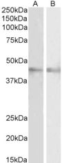 Anti-RNF13/RZF Antibody