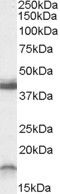 Anti-Ramp1-Mouse antibody (C-Term) (STJ71612)