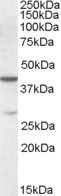 Anti-CBX8 antibody (Internal) (STJ71650)