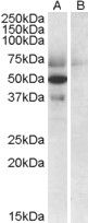 Anti-APOL4 antibody (C-Term) (STJ71652)
