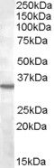 Anti-Bradykinin receptor B1 antibody (Internal) (STJ71667)
