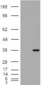 Anti-Monoglyceride Lipase antibody (Internal) (STJ71692)