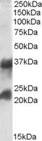 Anti-CTLA + CTLB antibody (Internal) (STJ71704)