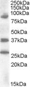 Anti-HOXD10 antibody (Internal) (STJ71706)