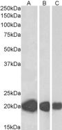 Anti-CSRP3 antibody (Internal) (STJ71802)